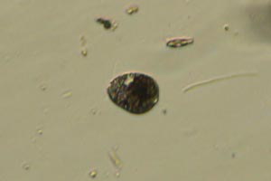 Euglenozoa