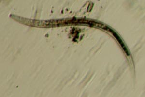 Roundworm