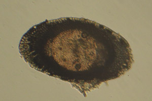 Plumatella statoblast