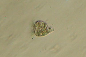 Strobilidium