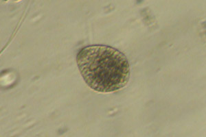 Ciliate