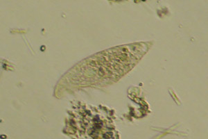 Blepharisma
