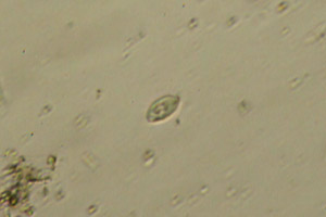 Ciliate
