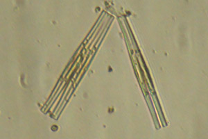 Fragilaria