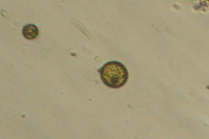 Diatom