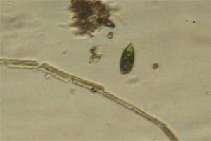 Euglenid, diatoms