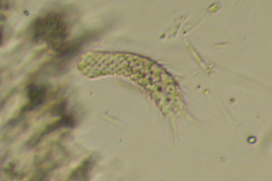 Chaetonotus