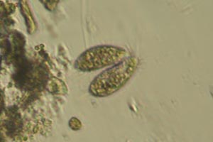 Spirotrichea conjugating