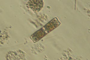 Diatom