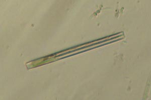Diatom