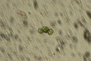 Chlorophyte