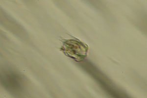 Hastatella