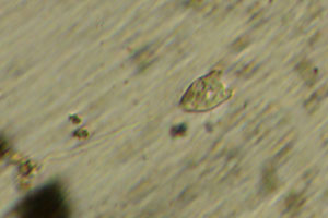 Vorticella