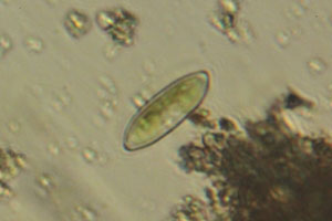 Diatom
