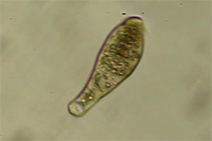 Ciliate