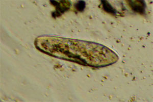 Paramecium