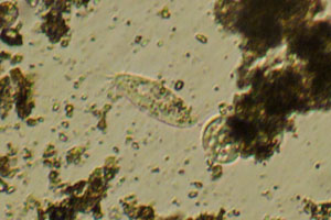 Spirotrich, ciliate