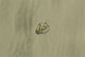 Ciliate