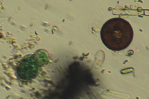 Nostocales, arcellid