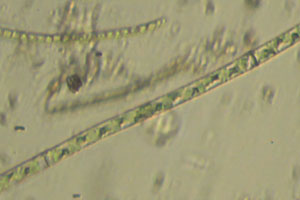 Spirogyra