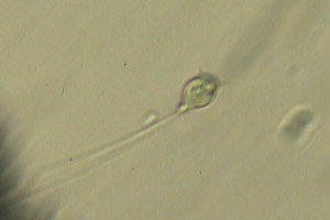 Vorticella