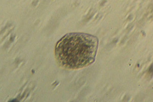 Ciliate