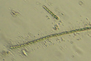 Cyanobacteria