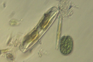 Diatoms