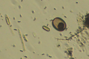 Trachelomonas lorica?