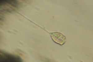 Vorticella