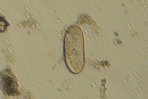 Ciliate