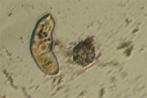 Metacineta