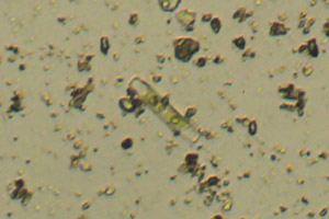 Diatom