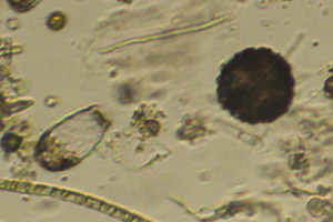 Euglyphida, Arcellinida