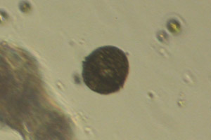 Dinoflagellate
