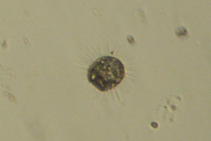 Acanthocystis