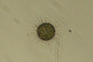 Acanthocystis