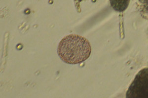 Lamprocystis roseopersicina